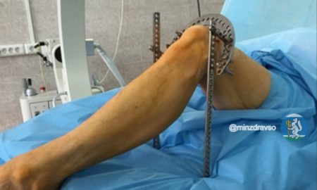 Человек после операции