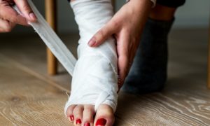 Перелом ноги