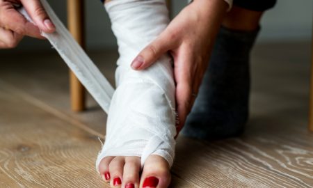 Перелом ноги