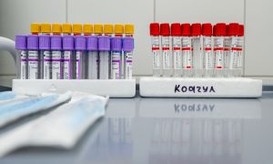 Взятие крови на ВИЧ