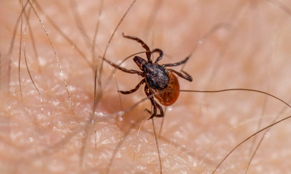 Клещ на теле