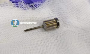 Стоматологическая отвертка