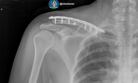 В Екатеринбурге спасли женщину