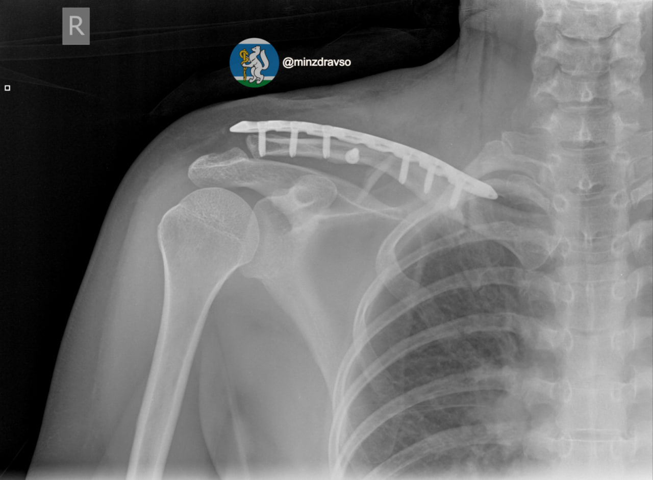 В Екатеринбурге спасли женщину