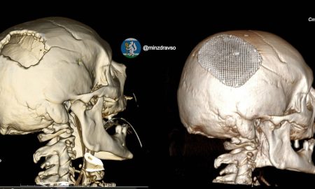 Мужчине пробило голову