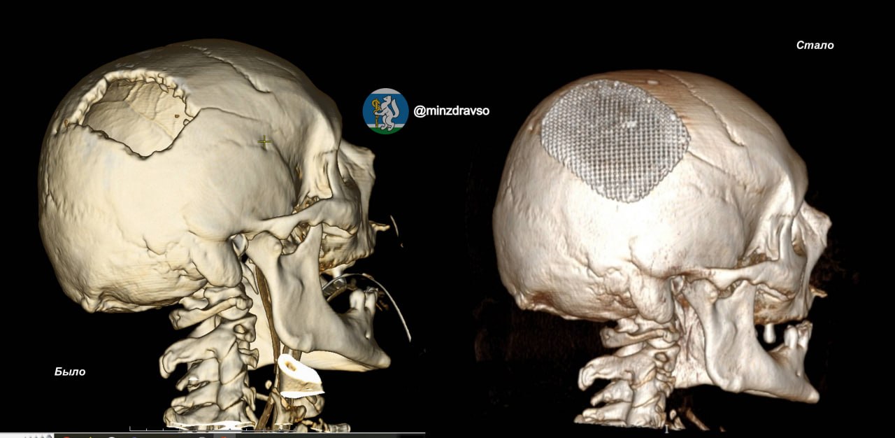 Мужчине пробило голову