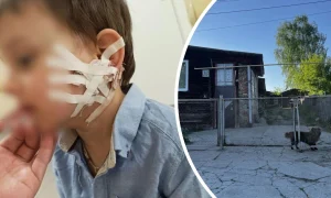 Собака покусала 3-летнего мальчика в Кировграде.