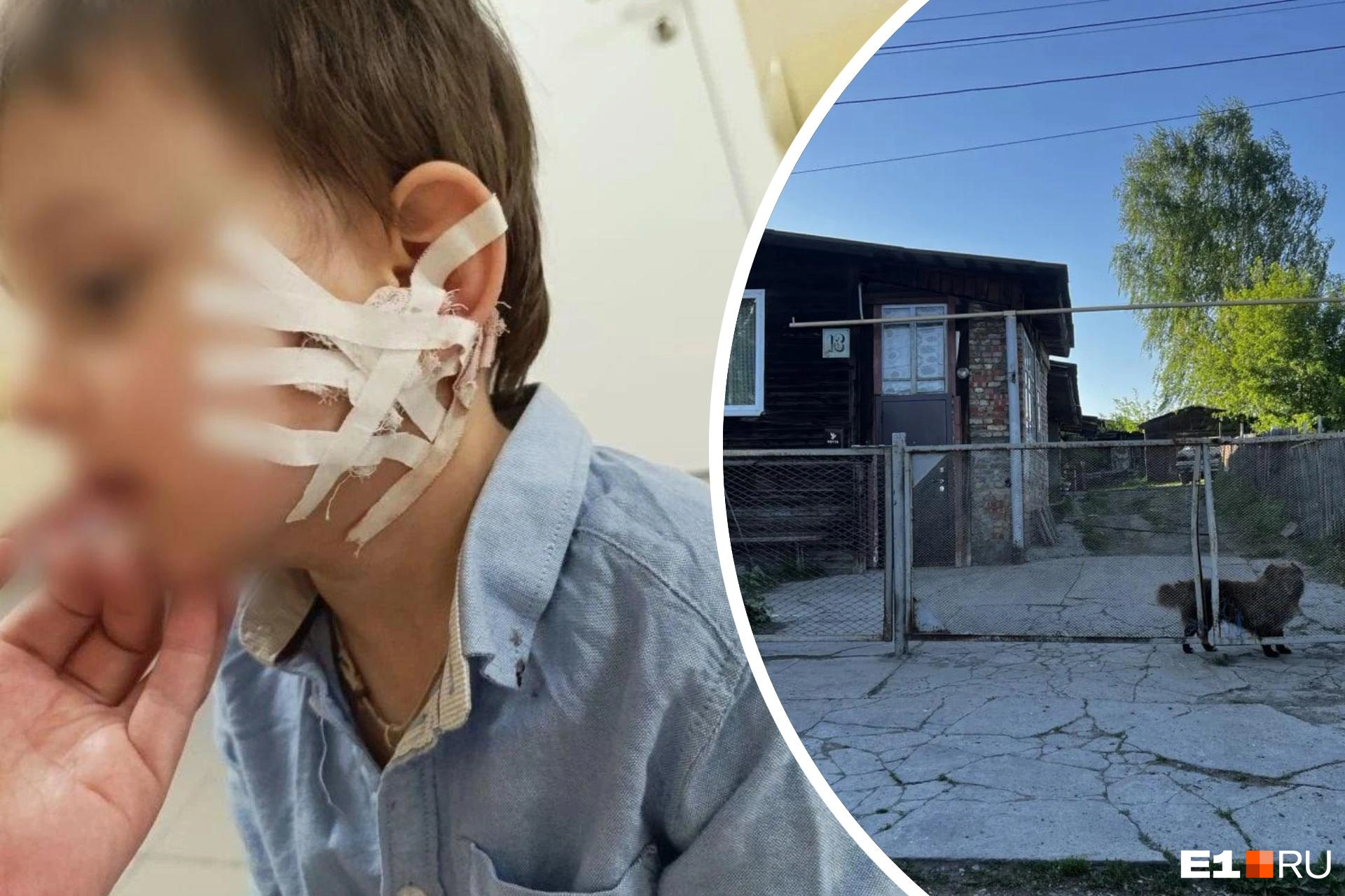 Собака покусала 3-летнего мальчика в Кировграде.