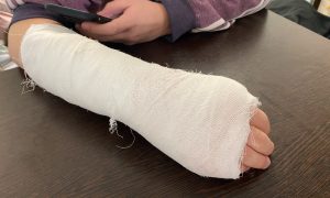 Ребенок с переломом руки