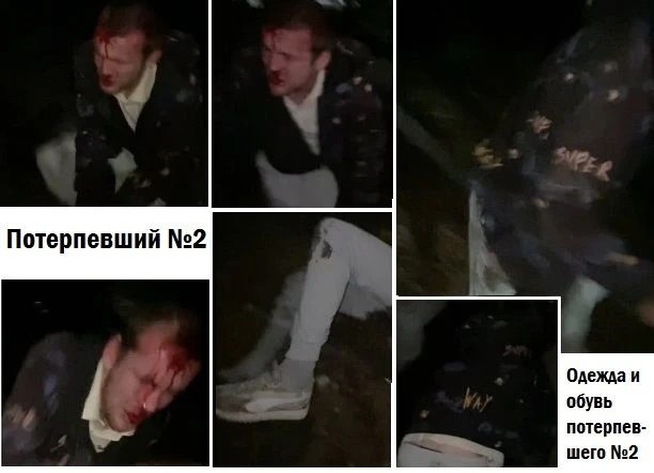 Пострадавшие от избиения